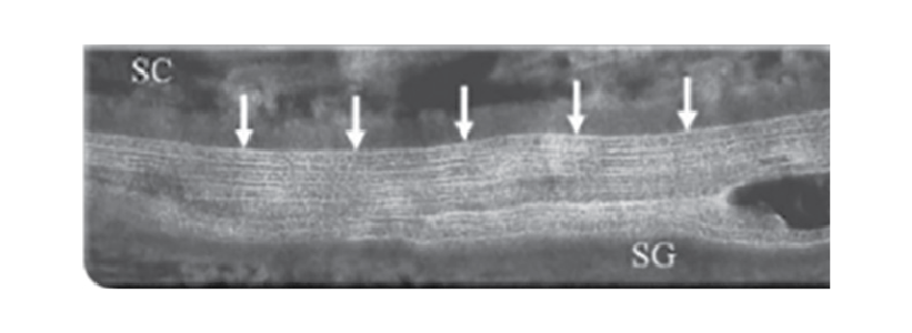 Елідел® відновлює шкірний бар’єр